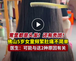 佛山5岁女童频繁肚子痛，检查后吓一跳：胃里都是头发！